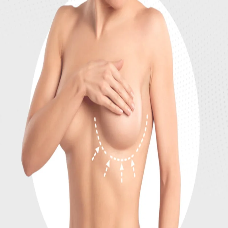 breast