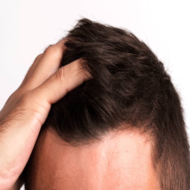 hair (2)