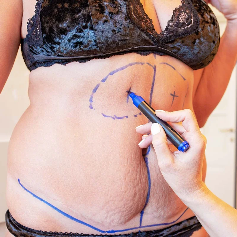 tummy